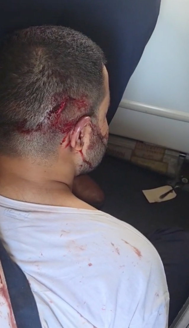 In this image taken from video provided by a passenger, a man identified by the passenger as the co-pilot of FlyDubai Flight FZ1073, accused of attacking the captain during the flight, sits with blood on the back of his head after the aircraft made an emergency landing in Tabuk, Saudi Arabia, Sept. 30, 2026. (Shota Musayev/UGC via AP)