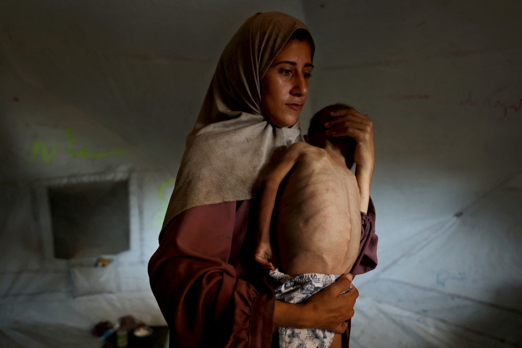 UN says Gaza malnutrition gains fragile as commercial supplies halt