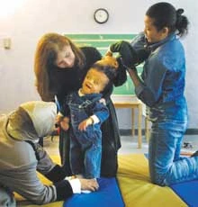 First Stage of Egyptian Twin Surgery Successful