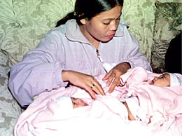 Filipina Siamese Twins Will Be Separated Next Month: Doctor