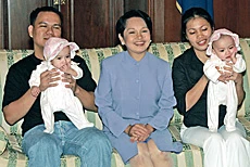 Filipino Twins Reach Home Separated but Together