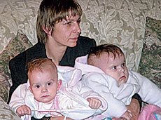 Surgery to Separate Polish Conjoined Twins Next Monday
