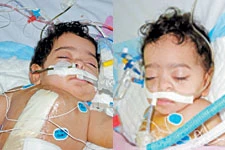Iraqi Twins Under ‘Close Supervision’