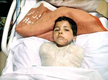 Boy’s Mishap Highlights Doctor Scarcity, Bureaucratic Delays