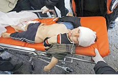 Civilians bear brunt of attack