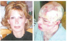 Victim of acid attack in Riyadh seeks retribution
