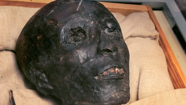 A frail King Tut died from malaria, broken leg