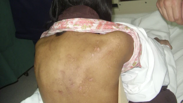 Hospital fears for abused maid’s life