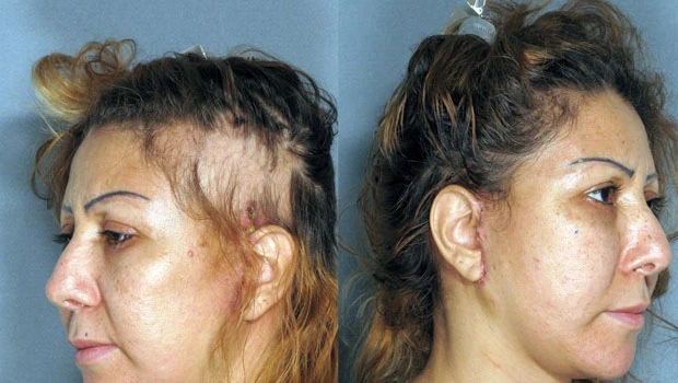Palestinian patient to sue plastic surgeons over deformities