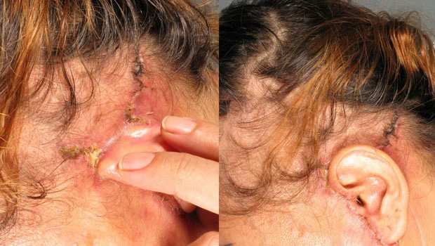 Palestinian female patient suing a plastic surgeon