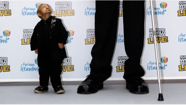 World's shortest man dies aged 21