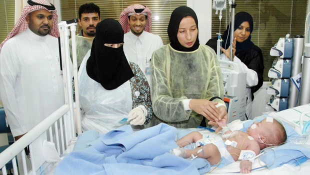 Jordanian twins’ condition stable
