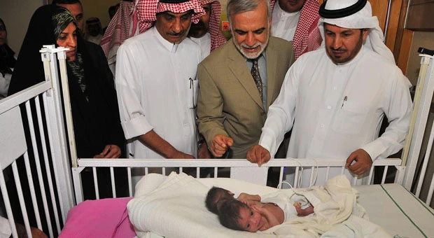 Iraqi conjoined twins arrive in Riyadh for separation