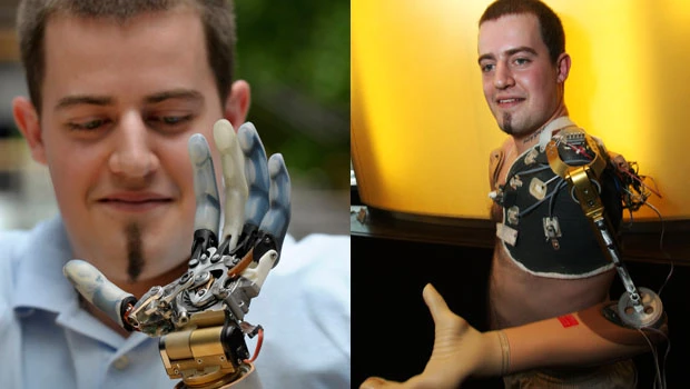 Austrian with high-tech robot arm dies after crash
