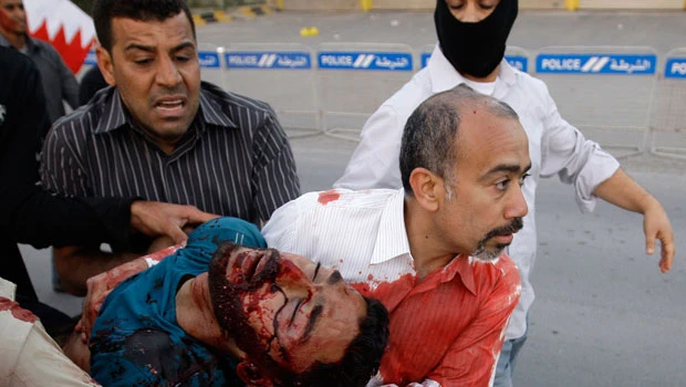 Scores injured in fresh Bahrain crackdown