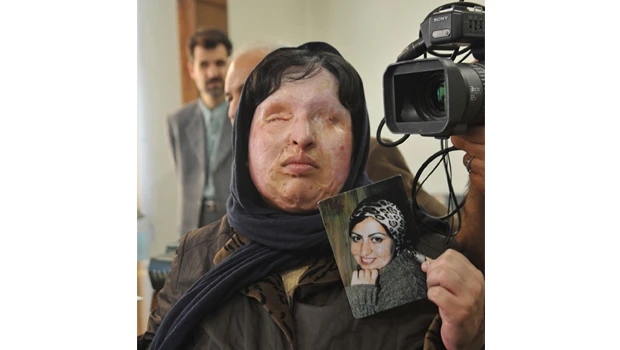 Iranian blinded by acid pardons her attacker