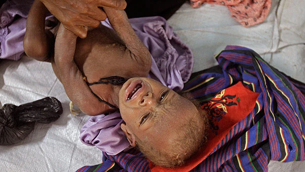 UN sets donors conference for Somalia famine