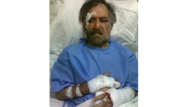 Syrian gunmen break artist’s hands as ‘warning’