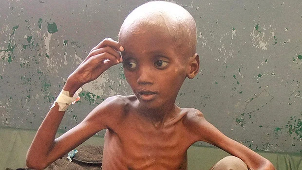 Somali official slams “ineffective” famine response