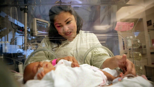 Palm-sized baby is now growing