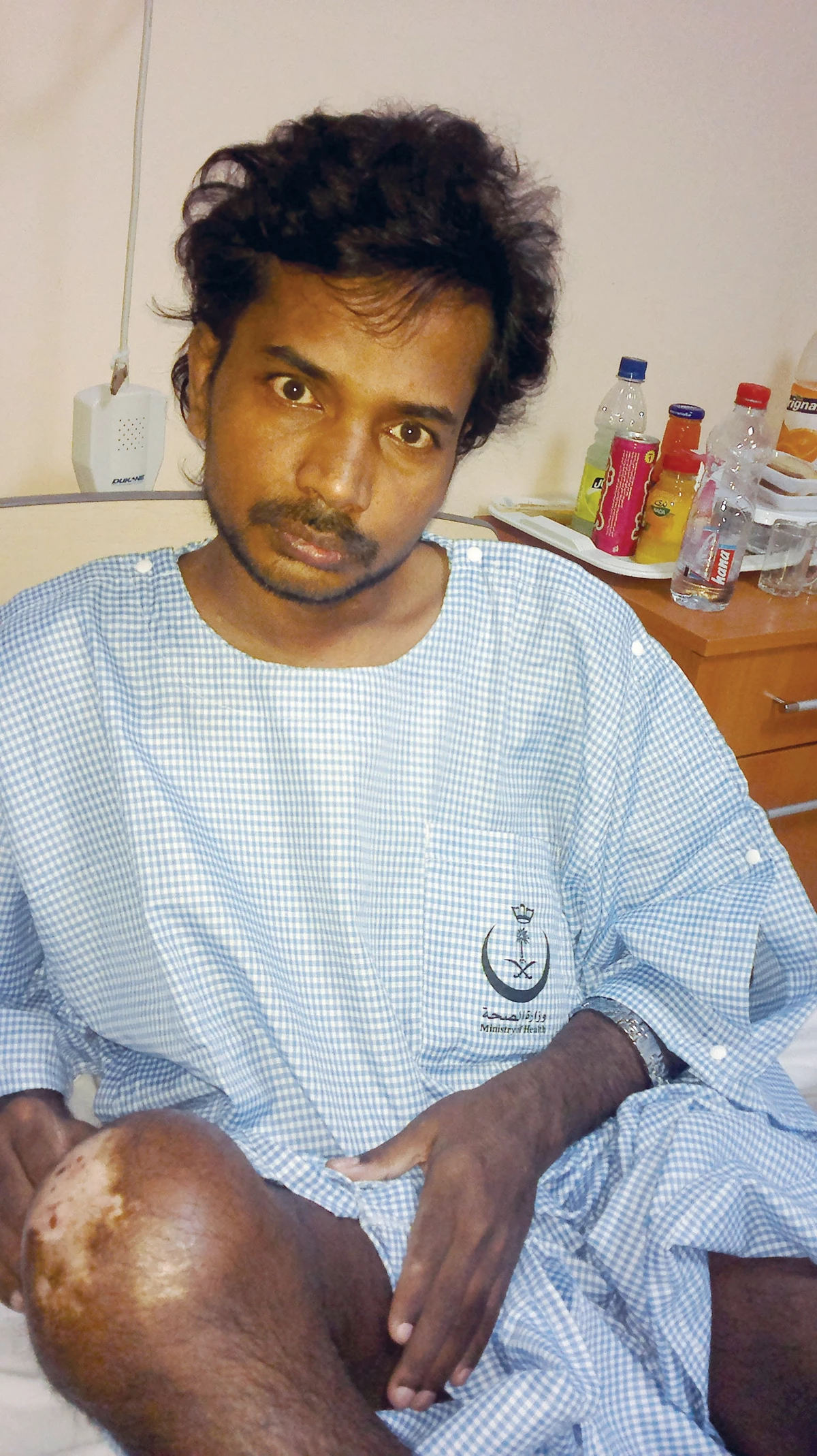 Indian mission seeks governorate's help to redress assaulted worker