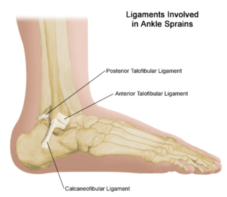 More soccer sprains when one ankle is stronger