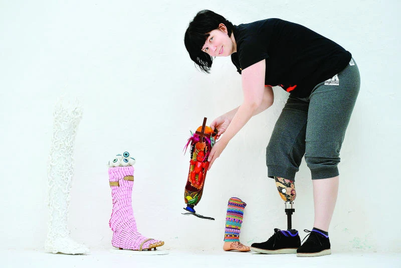 Prosthetic limbs get artistic makeover