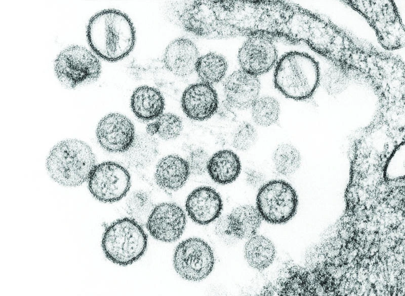 CDC says 10,000 at risk in Yosemite virus outbreak