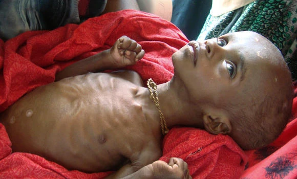 Three-quarters of African countries face food insecurity: report