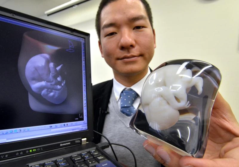 Japan firm offers 3D model of foetus