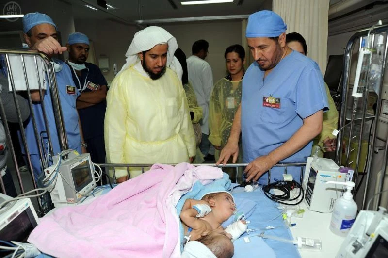 Separated twins in good health, says health minister