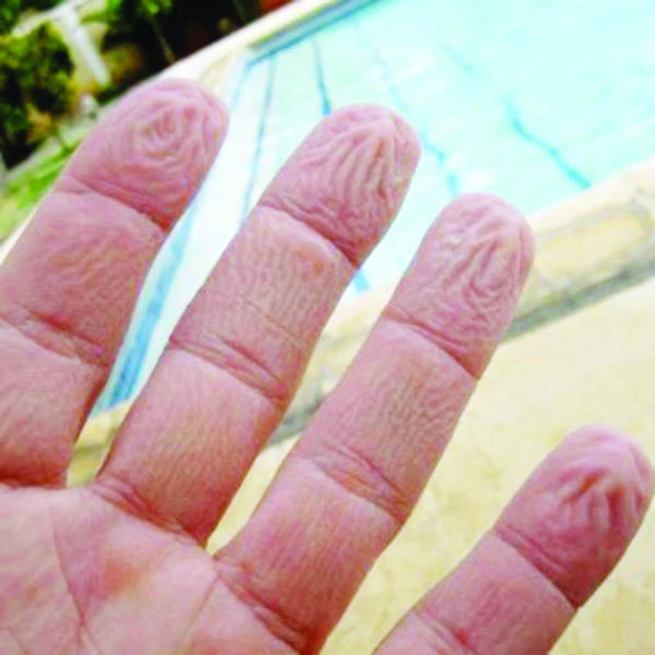 Science gets a grip on finger wrinkles