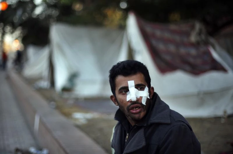 Gunmen shoot birdshot at Egypt protesters; 15 hurt