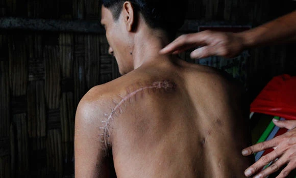 Indonesia pledges $1m in aid to Myanmar’s Rakhine state