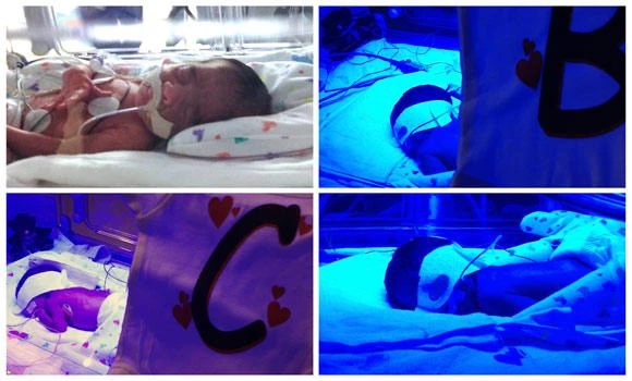 Texas woman has two sets of identical twins in one day