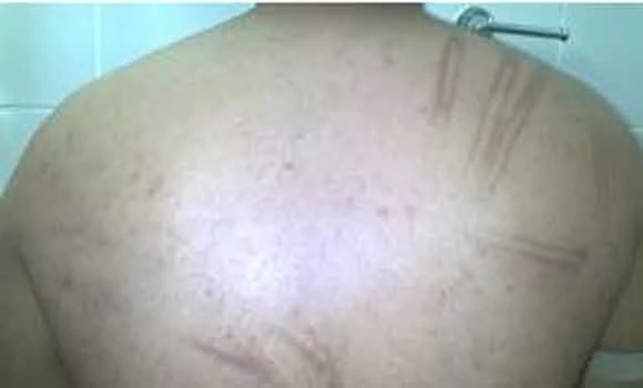 Case of 9-year-old boy abused by parents referred to court