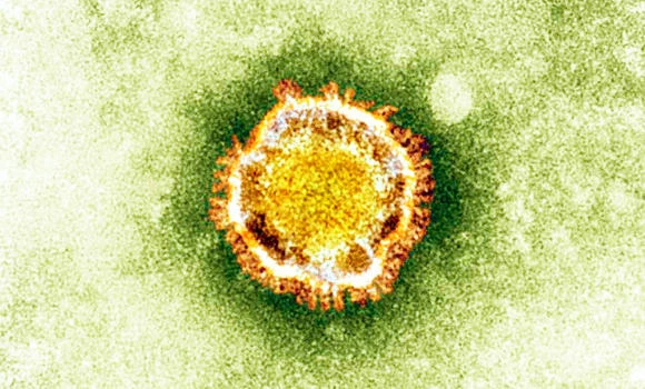 MoH confirms death of woman from rare form of coronavirus