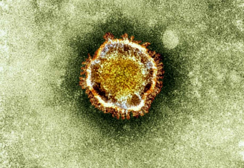 New case of SARS-like virus found in UK
