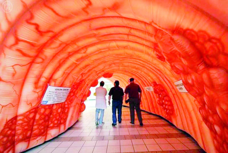 Large-size human colon model on display in Riyadh