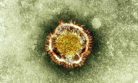 Patient with corona virus dies