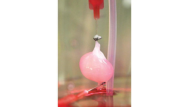 In lab, ‘bio-kidney’ offers hope for renal patients