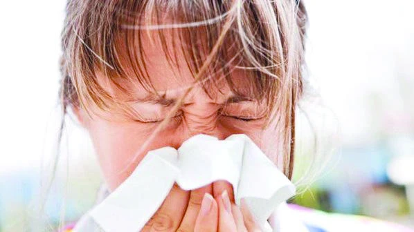Living in US raises risk of allergies