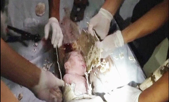 Rescuers save a newborn from sewer pipe in China