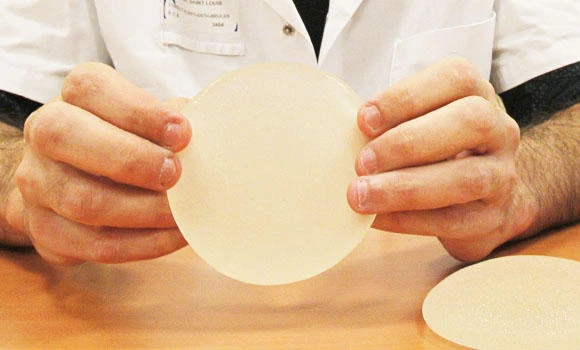 Breast implants may delay cancer diagnosis: study