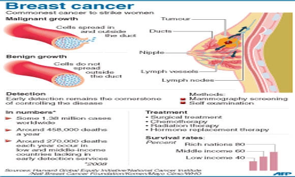 Study: Mastectomies on rise among young