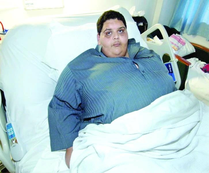 Man gets rid of 80 kg flab