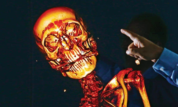 Sliced and diced, digitally: Autopsy as a service