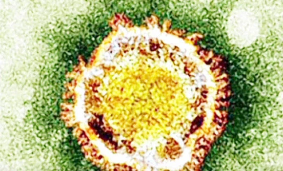 More MERS virus sources found