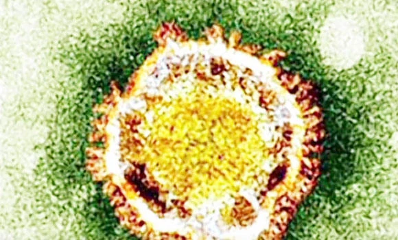 Asian diplomats briefed on MERS safety measures