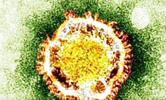 MERS kills two; Indian airports on alert